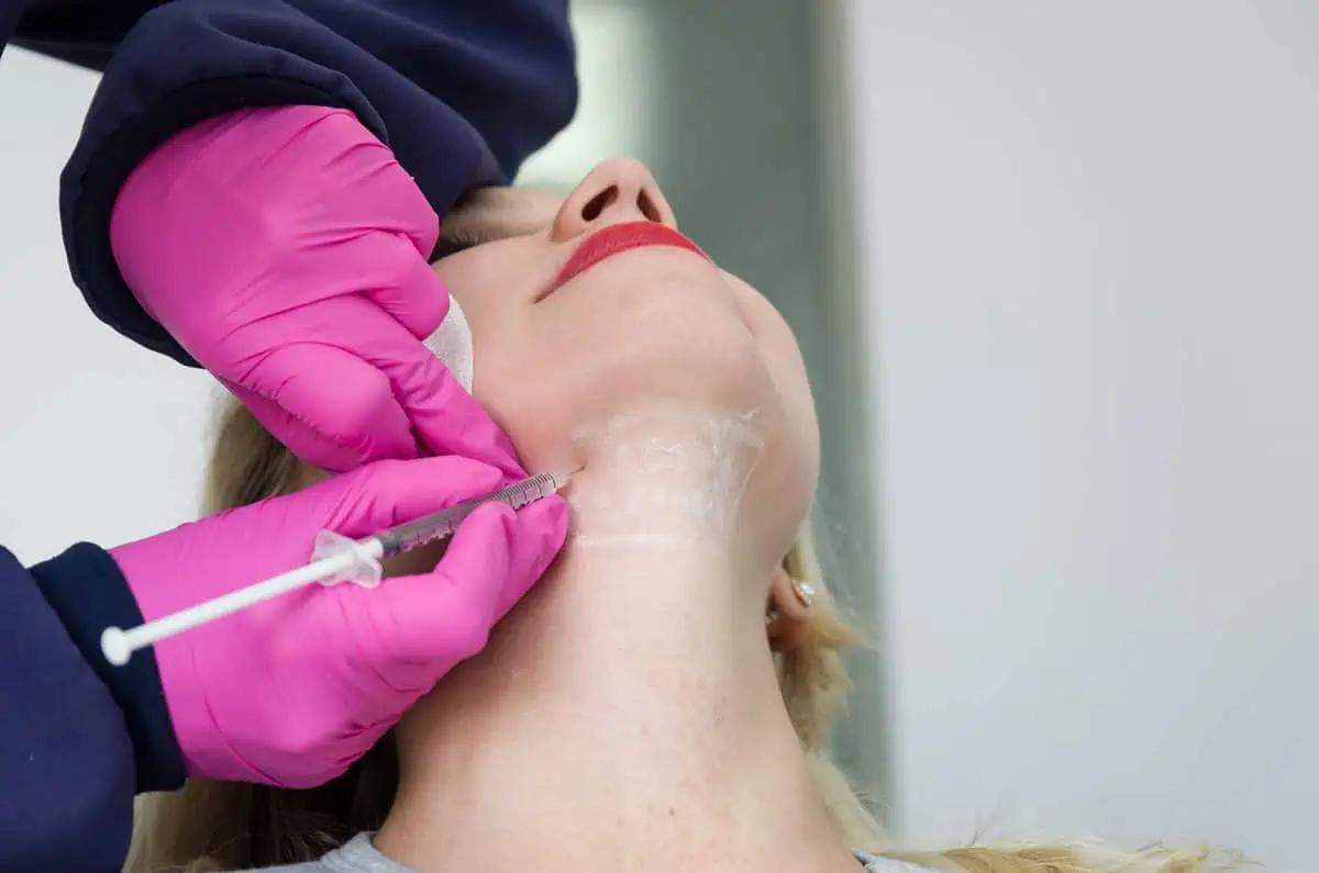 kybella treatment by Vivant Aesthetics and Wellness in Itasca, IL